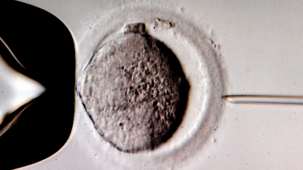 Mikroinjektion von Spermien in eine Eizelle