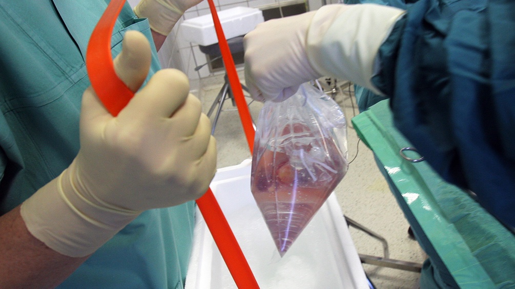 Ein Arzt hält eine Niere in einem Plastikbeutel in der Hand.