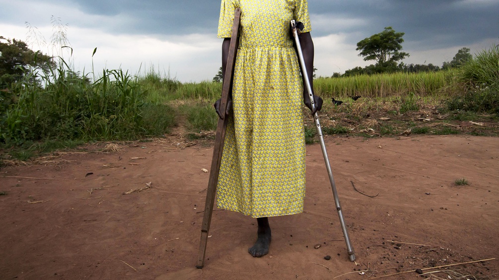 Frau mit einem amputierten Bein und Krücken in Uganda