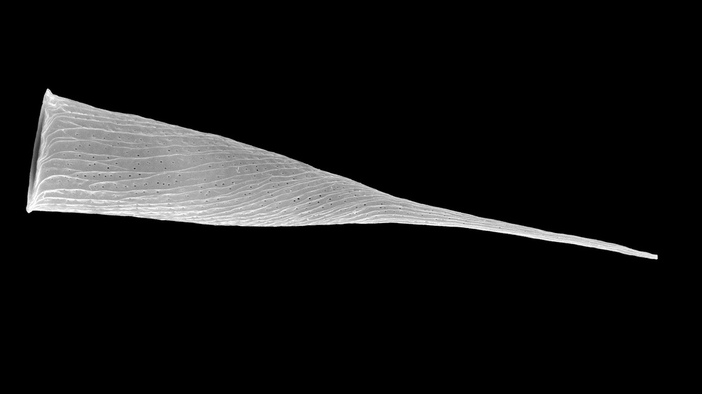 Das Wimpertier aus der Tintinnen-Gattung Rhabdonella im Rasterelektronenmikroskop. Der marine Planktonbewohner hat ein Gehäuse mit Oberflächenrippen und winzigen Öffnungen dazwischen.