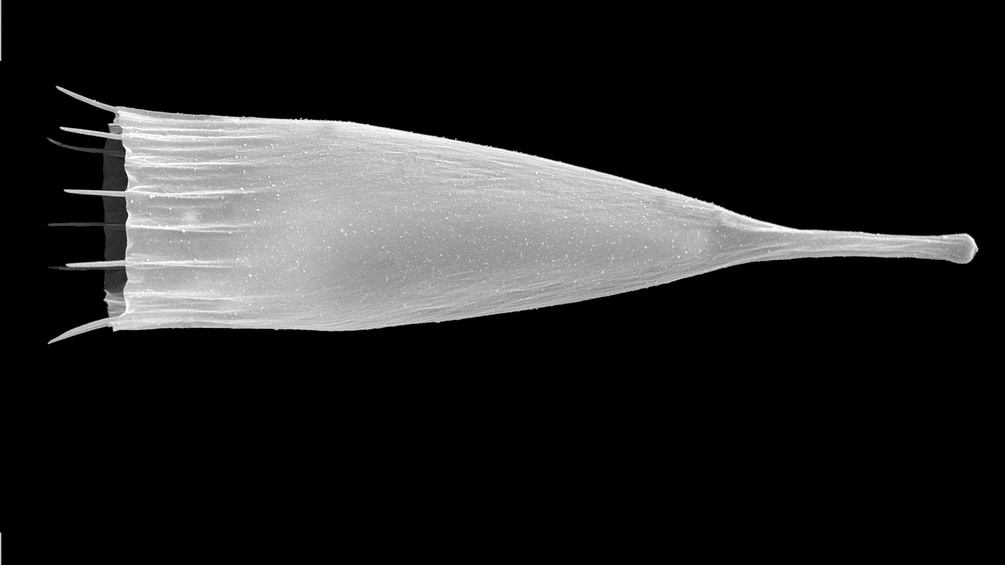 Das Wimpertier aus der Tintinnen-Gattung Dadayiella im Rasterelektronenmikroskop. Der marine Planktonbewohner hat ein Gehäuse mit kleinen Zähnchen am Mündungsrand.