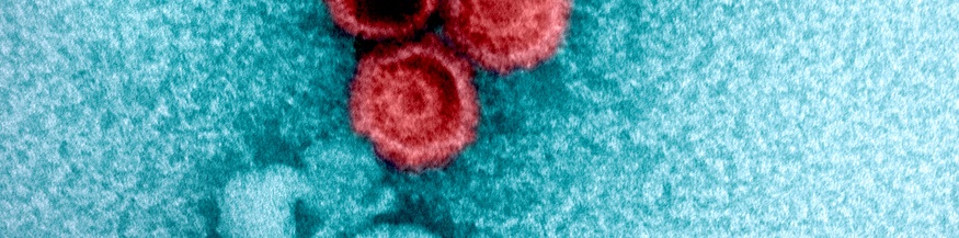 Epstein-Barr-Virus