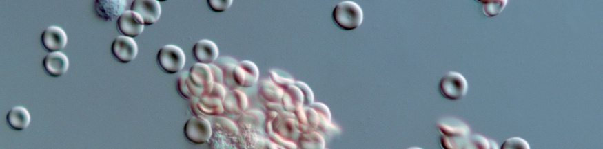 Rote Blutkörperchen unter dem Mikroskop