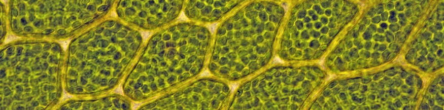 Zellen mit Chloroplasten in den Blaettchen einer Mnium-Art