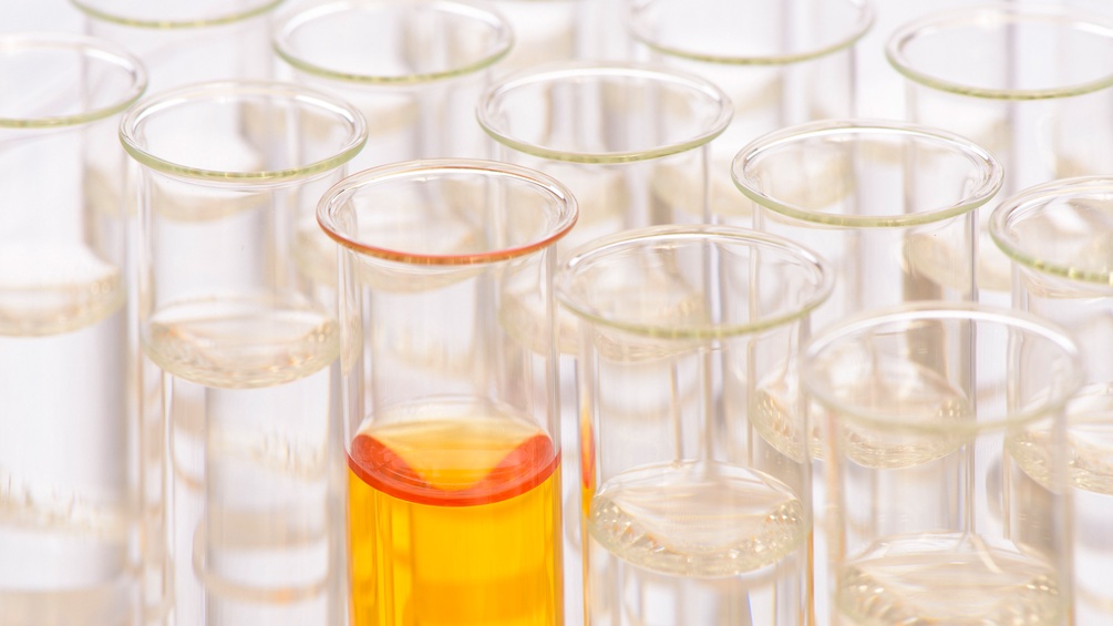 Reagenzgläser im Labor