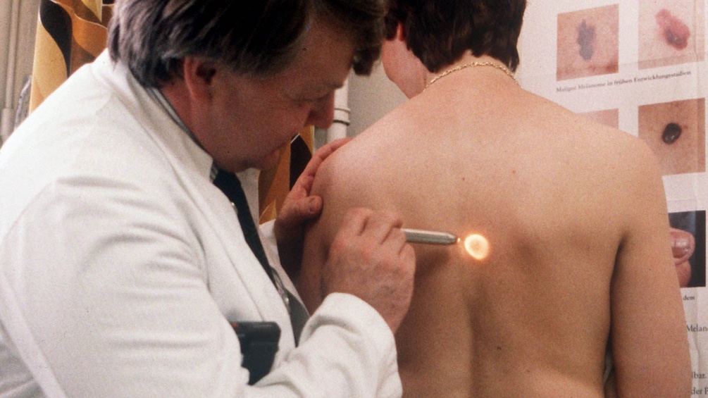 Ein Arzt untersucht den Rücken eines Mannes auf Hautkrebs.