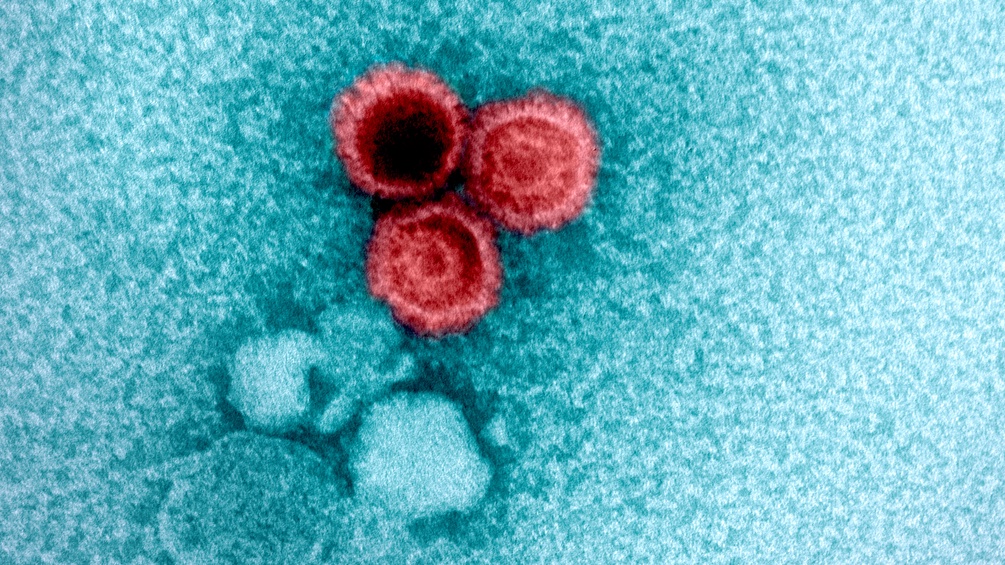 Epstein-Barr-Virus