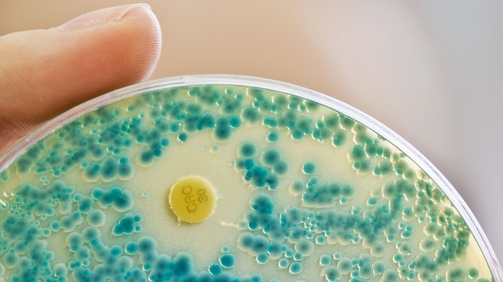 Indikator-Kulturplatte zum Nachweis von resistenten Bakterien 