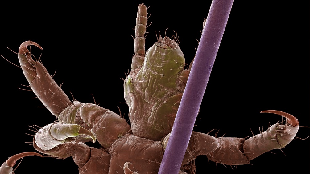 PICTUREDESK.COM/SCIENCE PHOTO LIBRARY/STEVE GSCHMEISSNER Kopflaus