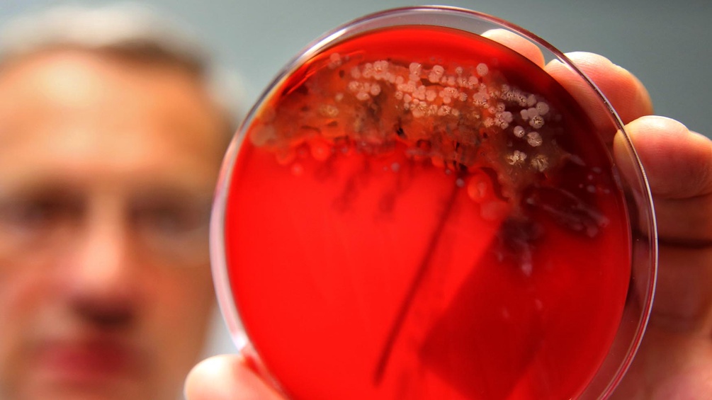  Mann hält eine Agarplatte mit Pseudomonas-Bakterien