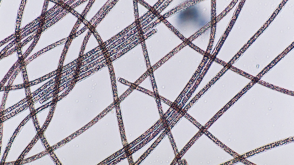 Algen unter dem Mikroskop.