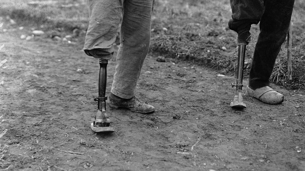 Zwei Männer mit Beinprothesen, 1916