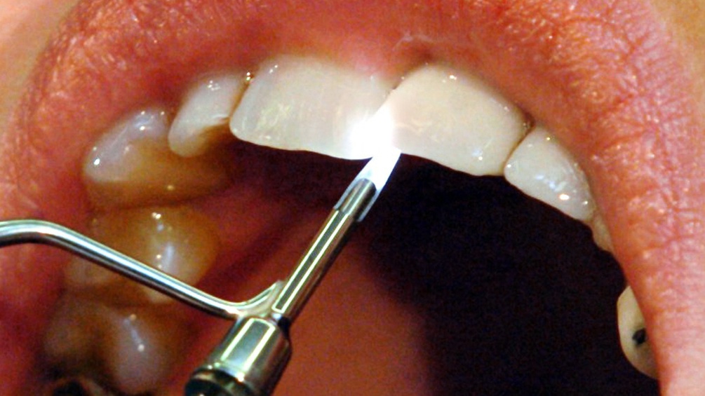 Ein Zahnarzt führt eine Dentalkamera an einer Patientin vor