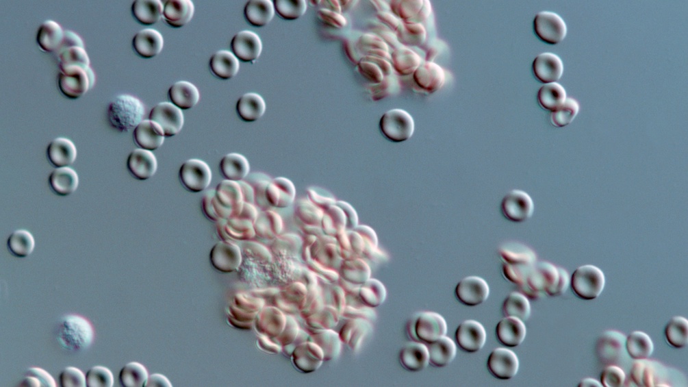 Rote Blutkörperchen unter dem Mikroskop