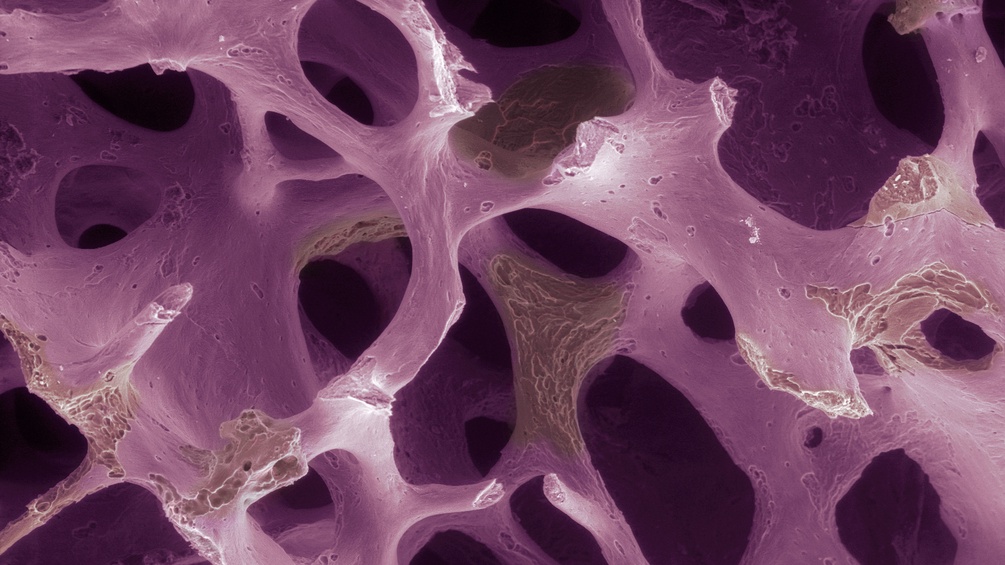 Zellen bei Osteoporose