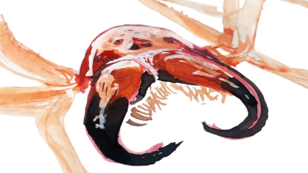 Illustration des Ammendornfingers