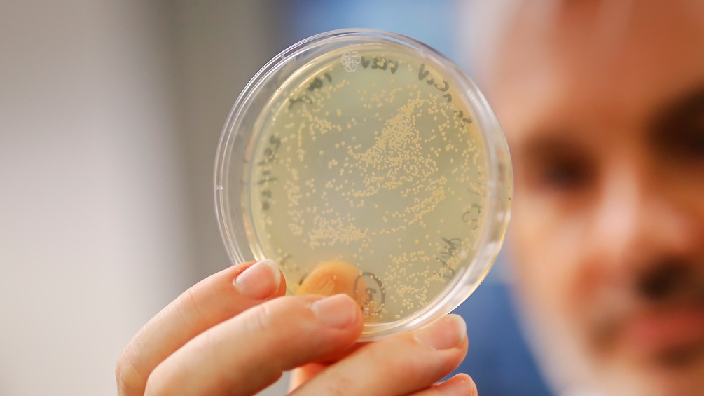 Der Corona Virus in einer Petri-Schale