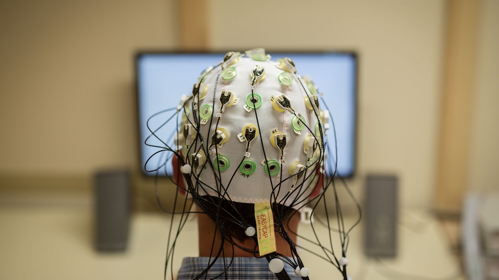 Kopf mit EEG-Sonden