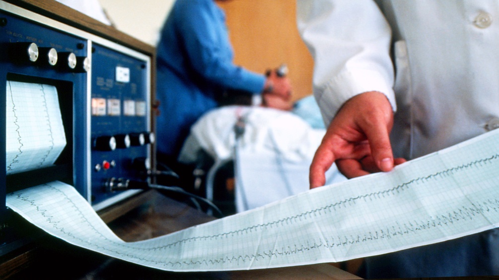 Elektrokrampftherapie