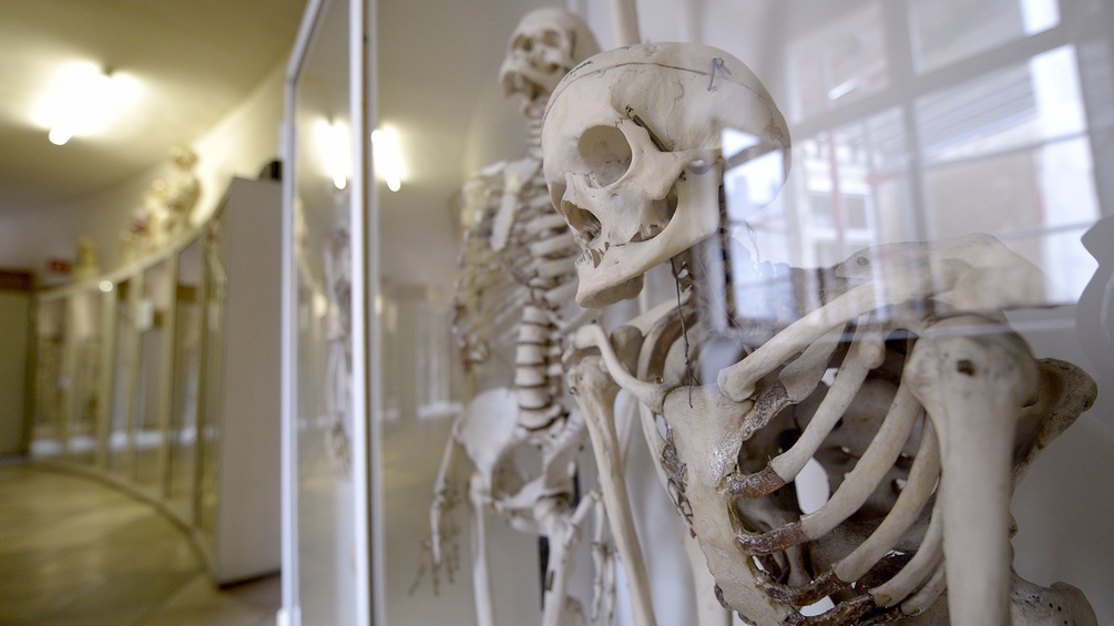 Skelette im Narrenturm im Naturhistorischen Museum Wien.
