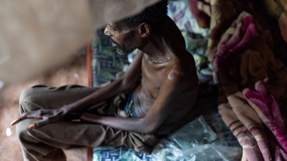 Ein Mann in Uganda, der mit HIV