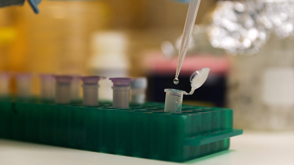 Hefepilz samples werden im Labor untersucht.
