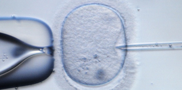 Mikroskopaufnahme einer künstlichen Befruchtung