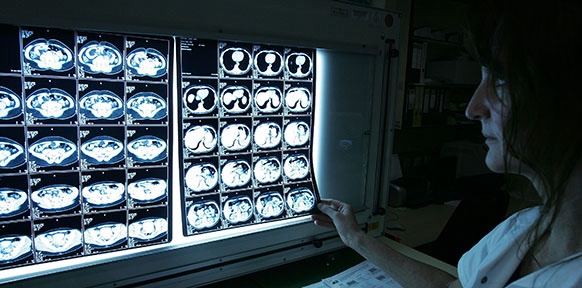 Ärztin blickt auf Röntgenbilder