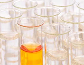 Reagenzgläser im Labor