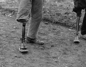 Zwei Männer mit Beinprothesen, 1916