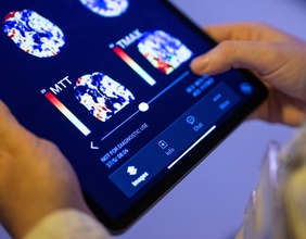 Gehirnaufnahmen auf einem Tablet
