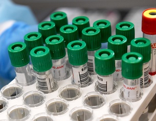 Ein Träger mit Röhrchen mit Proben, PCR Labor