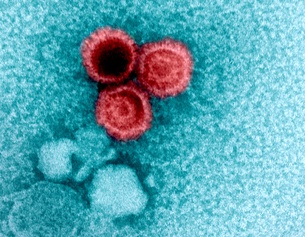 Epstein-Barr-Virus