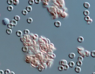 Rote Blutkörperchen unter dem Mikroskop