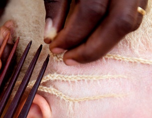 Junges Mädchen mit Albinismus bekommt ihre Haare geflochten