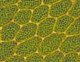 Zellen mit Chloroplasten in den Blaettchen einer Mnium-Art
